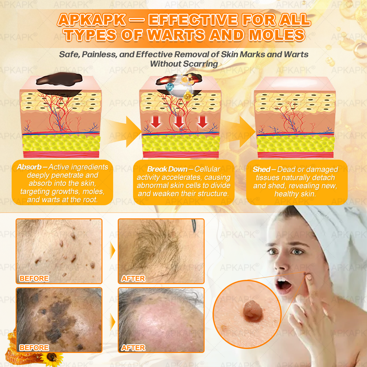 NEU & VERBESSERT ✨Bellelala® Bienengift Hauterneuerungscreme