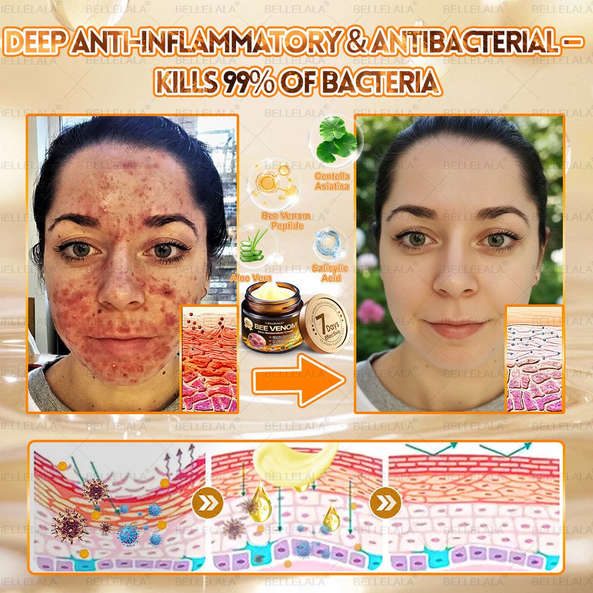 NEU & VERBESSERT ✨Bellelala® Bienengift Hauterneuerungscreme
