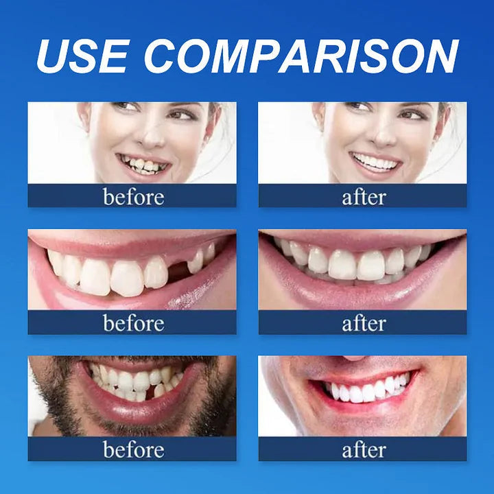 🌎Ends Today: 70% OFF! ⏰YUNPSOTM Medical Full Denture with Strong Suctiond Custom-Fit Full Functional Dentures🦷Obtain American Dental Association (ADA) Certification
