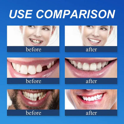 🌎Ends Today: 70% OFF! ⏰YUNPSOTM Medical Full Denture with Strong Suctiond Custom-Fit Full Functional Dentures🦷Obtain American Dental Association (ADA) Certification